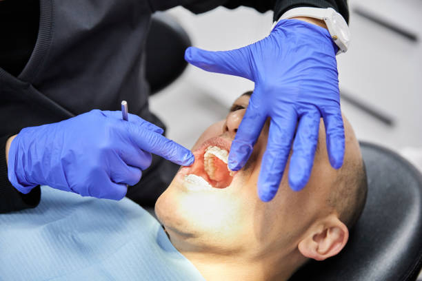 Best Emergency Tooth Extraction in Phoenix, NY